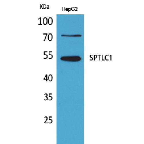 SPTLC1 / HSN1 Antibody - Western blot of SPTLC1 antibody