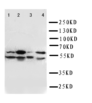 SPTLC1 / HSN1 Antibody - WB of SPTLC1 / HSN1 antibody. Lane 1: W620 Cell Lysate. Lane 2: S549 Cell Lysate. Lane 3: PANC Cell Lysate. Lane 4: U87 Cell Lysate.