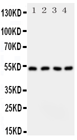 SPTLC1 / HSN1 Antibody - Anti-SPTLC1 antibody, Western blotting All lanes: Anti SPTLC1 at 0.5ug/ml Lane 1: SW620 Whole Cell Lysate at 40ug Lane 2: S549 Whole Cell Lysate at 40ug Lane 3: PANC Whole Cell Lysate at 40ug Lane 4: U87 Whole Cell Lysate at 40ug Predicted bind size: 53KD Observed bind size: 53KD