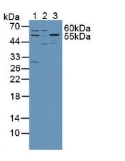 SPTLC1 / HSN1 Antibody - Western Blot; Sample: Lane1: Mouse Liver Tissue; Lane2: Mouse Lung Tissue; Lane3: Mouse Brain Tissue; Lane4: Human Jurkat Cells.