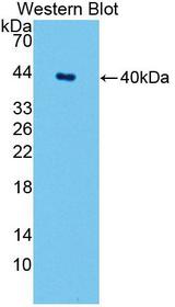 SPTLC1 / HSN1 Antibody - Western blot of SPTLC1 / HSN1 antibody.