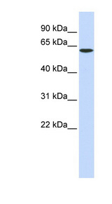 SPTLC1 / HSN1 Antibody - SPTLC1 antibody Western blot of Fetal Brain lysate. This image was taken for the unconjugated form of this product. Other forms have not been tested.