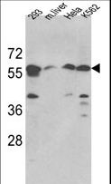 SPTLC1 / HSN1 Antibody - Western blot of hSPTLC1-S41 in 293, HeLa, K562 cell line and mouse liver tissue lysates (35 ug/lane). SPTLC1 (arrow) was detected using the purified antibody.
