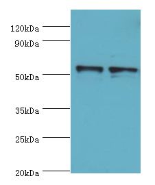 SPTLC1 / HSN1 Antibody - Western blot. All lanes: Serine palmitoyltransferase 1 antibody at 8 ug/ml <br/>. Lane 1: 293T whole cell lysate<br/>. Lane 2: MCF-7 whole cell lysate <br/>. secondary <br/> Goat polyclonal to rabbit at 1:10000 dilution <br/>. Predicted band size: 53 kDa <br/>. Observed band size: 53 kDa.