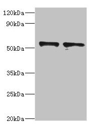 SPTLC1 / HSN1 Antibody - Western blot All lanes: SPTLC1 antibody at 8µg/ml Lane 1: 293T whole cell lysate Lane 2: MCF-7 whole cell lysate Secondary Goat polyclonal to rabbit IgG at 1/10000 dilution Predicted band size: 53, 17 kDa Observed band size: 53 kDa