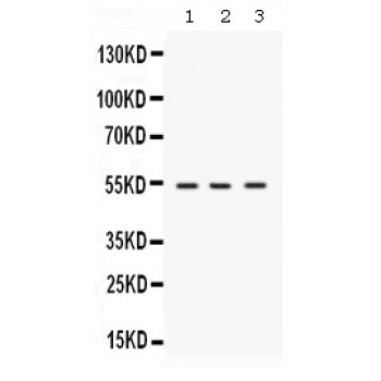 SPTLC1 / HSN1 Antibody - Western blot analysis of SPTLC1 expression in rat brain extract (lane 1), mouse brain extract (lane 2) and MCF-7 whole cell lysates (lane 3). SPTLC1 at 53 kD was detected using rabbit anti- SPTLC1 Antigen Affinity purified polyclonal antibody at 0.5 ug/mL. The blot was developed using chemiluminescence (ECL) method.