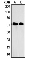 SPTLC1 / HSN1 Antibody - Western blot analysis of HSN1 expression in HEK293T (A); SHSY5Y (B) whole cell lysates.
