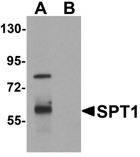 SPTLC1 / HSN1 Antibody - Western blot analysis of SPT1 in human lung tissue lysate with SPT1 antibody at 1 ug/ml in (A) the absence and (B) the presence of blocking peptide.