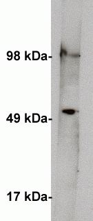 SPTLC1 / HSN1 Antibody - Western blot on human kidney lysate (10 ug/lane) using anti Serine palmitoyltransferase 1 antibody (Serine Palmitoyltransferase 1) at 1 ug/ml. Blot was developed using anti rabbit HRP at 1:75k and Pierce Supersignal West Femto. Exposure was 2 minutes.