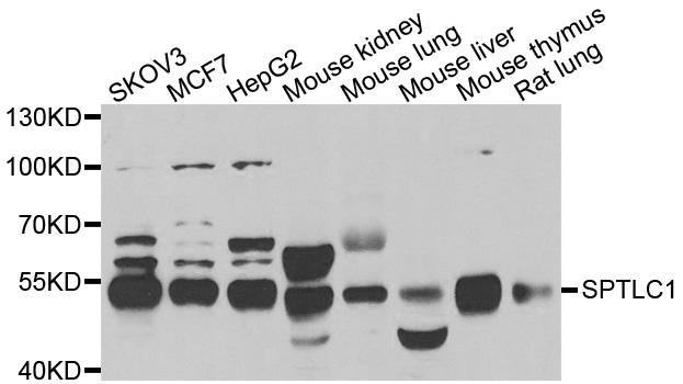 SPTLC1 / HSN1 Antibody - Western blot analysis of extracts of various cell lines.