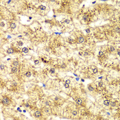 SPTLC1 / HSN1 Antibody - Immunohistochemistry of paraffin-embedded human liver injury tissue.