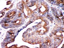 SPTLC1 / HSN1 Antibody