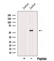 SPTLC1 / HSN1 Antibody - Western blot analysis of extracts of HepG2 cells using SPTLC1 antibody. The lane on the left was treated with blocking peptide.