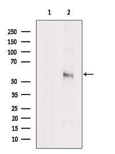SPTLC1 / HSN1 Antibody