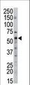 SPTLC2 / LCB2 Antibody - The anti-SPTLC2 antibody is used in Western blot to detect SPTLC2 in mouse liver tissue lysate.