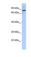 SPTLC2 / LCB2 Antibody - SPTLC2 antibody Western blot of HepG2 cell lysate. This image was taken for the unconjugated form of this product. Other forms have not been tested.