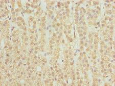 SPTLC2 / LCB2 Antibody - Immunohistochemistry of paraffin-embedded human adrenal gland tissue using SPTLC2 Antibody at dilution of 1:100