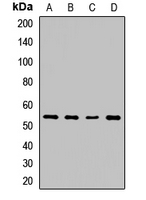 SPTLC2 / LCB2 Antibody