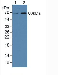 SPTLC3 / C20orf38 Antibody - Western Blot; Sample: Lane1: Human Hela Cells; Lane2: Human 293T Cells.