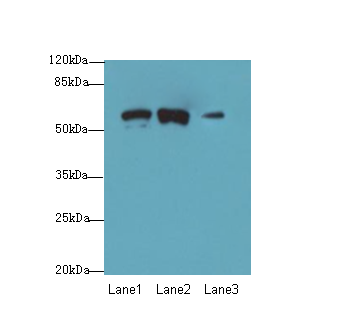 SPTLC3 / C20orf38 Antibody - Western blot. All lanes: SPTLC3 antibody at 0.2 ug/ml. Lane 1: Mouse liver tissue. Lane 2: Mouse kidney tissue. Lane 3: U87 whole cell lysate. Secondary Goat polyclonal to Rabbit IgG at 1:10000 dilution. Predicted band size: 62 kDa. Observed band size: 62 kDa.