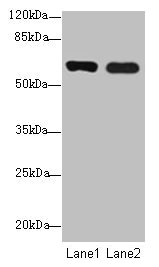 SPTLC3 / C20orf38 Antibody - Western blot All lanes: SPTLC3 antibody at 0.2µg/ml Lane 1: Mouse kidney tissue Lane 2: U87 whole cell lysate Secondary Goat polyclonal to rabbit IgG at 1/10000 dilution Predicted band size: 63, 20 kDa Observed band size: 63 kDa
