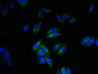 SPTLC3 / C20orf38 Antibody - Immunofluorescent analysis of HepG2 cells using SPTLC3 Antibody at dilution of 1:100 and Alexa Fluor 488-congugated AffiniPure Goat Anti-Rabbit IgG(H+L)