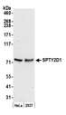 SPTY2D1 Antibody - Detection of human SPTY2D1 by western blot. Samples: Whole cell lysate (50 µg) from HeLa and 293T cells prepared using NETN lysis buffer. Antibody: Affinity purified rabbit anti-SPTY2D1 antibody used for WB at 0.4 µg/ml. Detection: Chemiluminescence with an exposure time of 3 minutes.