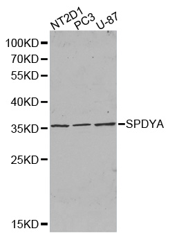 SPY1 / SPDYA Antibody - Western blot analysis of extracts of various cell lines.