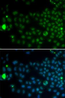SPY1 / SPDYA Antibody - Immunofluorescence analysis of MCF7 cells.