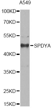 SPY1 / SPDYA Antibody - Western blot analysis of extracts of A549 cells, using SPDYA antibody at 1:1000 dilution. The secondary antibody used was an HRP Goat Anti-Rabbit IgG (H+L) at 1:10000 dilution. Lysates were loaded 25ug per lane and 3% nonfat dry milk in TBST was used for blocking. An ECL Kit was used for detection and the exposure time was 10s.