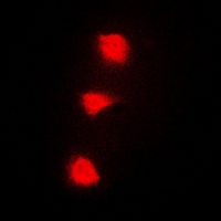 SPZ1 Antibody - Immunofluorescent analysis of SPZ1 staining in A549 cells. Formalin-fixed cells were permeabilized with 0.1% Triton X-100 in TBS for 5-10 minutes and blocked with 3% BSA-PBS for 30 minutes at room temperature. Cells were probed with the primary antibody in 3% BSA-PBS and incubated overnight at 4 deg C in a humidified chamber. Cells were washed with PBST and incubated with a DyLight 594-conjugated secondary antibody (red) in PBS at room temperature in the dark. DAPI was used to stain the cell nuclei (blue).