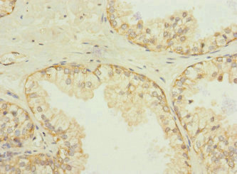 SQRDL Antibody - Immunohistochemistry of paraffin-embedded human prostate tissue at dilution 1:100