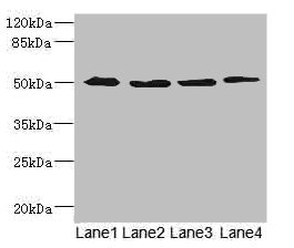 SQRDL Antibody - Western blot All Lanes: SQRDL antibody at 4.67ug/ml Lane 1: A549 whole cell lysate Lane 2: A431 whole cell lysate Lane 3: Hela whole cell lysate Lane 4: HepG-2 whole cell lysate Secondary Goat polyclonal to rabbit IgG at 1/10000 dilution Predicted band size: 50 kDa Observed band size: 50 kDa
