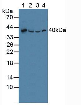 SQSTM1 Antibody - Western Blot; Sample: Lane1: Human Liver Tissue; Lane2: Porcine Liver Tissue; Lane3: Mouse Liver Tissue; Lane4: Human 293T Cells.