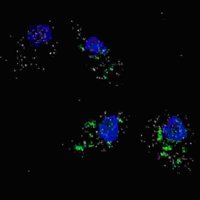 SQSTM1 Antibody - Fluorescent image of U251 cells stained with SQSTM1 (p62) antibody. U251 cells were treated with Chloroquine (50 mu M,16h), then fixed with 4% PFA (20 min), permeabilized with Triton X-100 (0.2%, 30 min). Cells were then incubated SQSTM1 (p62) primary antibody (1:200, 2 h at room temperature). For secondary antibody, Alexa Fluor 488 conjugated donkey anti-rabbit antibody (green) was used (1:1000, 1h). Nuclei were counterstained with Hoechst 33342 (blue) (10 ug/ml, 5 min). SQSTM1 (p62) immunoreactivity is localized to autophagic vacuoles in the cytoplasm of U251 cells, supported by Human Protein Atlas Data (http://www.proteinatlas.org/ENSG00000161011).