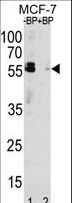 SQSTM1 Antibody - Western blot of SQSTM1 Antibody (C331) antibody pre-incubated without(lane 1) and with(lane 2) blocking peptide in MCF-7 cell line lysate. SQSTM1 Antibody (C331) (arrow) was detected using the purified antibody.
