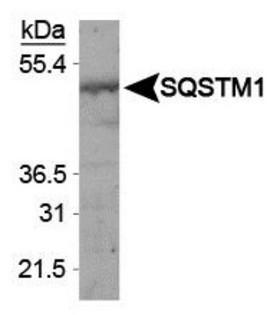 SQSTM1 Antibody - Western Blot: p62/SQSTM1 Antibody - Analysis of SQSTM1 in HeLa whole cell extracts.  This image was taken for the unconjugated form of this product. Other forms have not been tested.