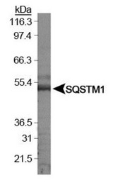SQSTM1 Antibody - Western Blot: p62/SQSTM1 Antibody - Analysis of SQSTM1 in HeLa whole cell extracts.  This image was taken for the unconjugated form of this product. Other forms have not been tested.