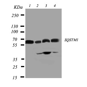 SQSTM1 Antibody - WB of P62 / SQSTM1 antibody. Lane 1: Rat Brain Tissue Lysate. Lane 2: HELA Cell Lysate. Lane 3: U87 Cell Lysate. Lane 4: A549 Cell Lysate.