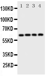 SQSTM1 Antibody - Anti-SQSTM1/p62 antibody, Western blotting Lane 1: Rat Brain Tissue LysateLane 2: HELA Cell LysateLane 3: U87 Cell LysateLane 4: A549 Cell Lysate