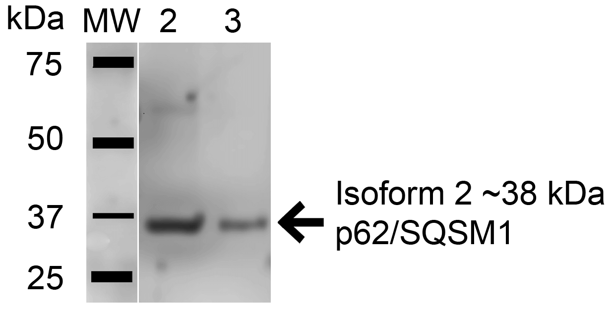 SQSTM1 Antibody - Western blot analysis of Human HeLa and HEK293Trap cell lysates showing detection of 47.7 kDa SQSTM1 protein using Rabbit Anti-SQSTM1 Polyclonal Antibody. Lane 1: Molecular Weight Ladder (MW). Lane 2: HeLa cell lysates. Lane 3: 293Trap cell lysates. Load: 15 µg. Block: 5% Skim Milk in 1X TBST. Primary Antibody: Rabbit Anti-SQSTM1 Polyclonal Antibody  at 1:1000 for 1 hour at RT. Secondary Antibody: Goat Anti-Rabbit HRP at 1:2000 for 60 min at RT. Color Development: ECL solution for 6 min in RT. Predicted/Observed Size: 47.7 kDa. Other Band(s): ~60 in Jurkat.