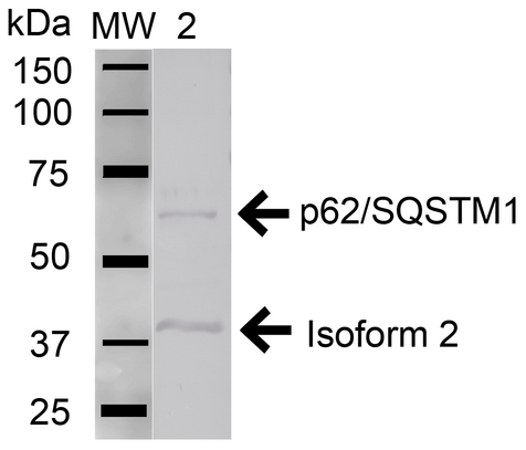 SQSTM1 Antibody - Western blot analysis of Human Jurkat cell lysates showing detection of 47.7 kDa SQSTM1 protein using Rabbit Anti-SQSTM1 Polyclonal Antibody. Lane 1: Molecular Weight Ladder (MW). Lane 2: Human Jurkat cell lysates. Load: 15 µg. Block: 5% Skim Milk in 1X TBST. Primary Antibody: Rabbit Anti-SQSTM1 Polyclonal Antibody  at 1:1000 for 1 hour at RT. Secondary Antibody: Goat Anti-Rabbit HRP at 1:2000 for 60 min at RT. Color Development: ECL solution for 6 min in RT. Predicted/Observed Size: 47.7 kDa. Other Band(s): ~60.