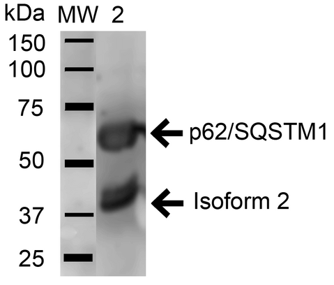 SQSTM1 Antibody - Western blot analysis of Mouse Brain cell lysates showing detection of 47.7 kDa SQSTM1 protein using Rabbit Anti-SQSTM1 Polyclonal Antibody. Lane 1: Molecular Weight Ladder (MW). Lane 2: Mouse Brain cell lysates. Load: 15 µg. Block: 5% Skim Milk in 1X TBST. Primary Antibody: Rabbit Anti-SQSTM1 Polyclonal Antibody  at 1:1000 for 1 hour at RT. Secondary Antibody: Goat Anti-Rabbit HRP at 1:2000 for 60 min at RT. Color Development: ECL solution for 6 min in RT. Predicted/Observed Size: 47.7 kDa.
