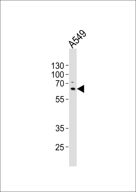 SQSTM1 Antibody - Western blot of lysate from A549 cell line, using SQSTM1 antibody diluted at 1:1000. A goat anti-mouse IgG H&L (HRP) at 1:3000 dilution was used as the secondary antibody. Lysate at 20 ug.