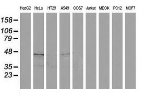 SQSTM1 Antibody - Western blot of extracts (35ug) from 9 different cell lines by using anti-SQSTM1 monoclonal antibody.
