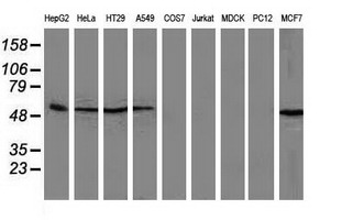 SQSTM1 Antibody - Western blot of extracts (35ug) from 9 different cell lines by using anti-SQSTM1 monoclonal antibody (HepG2: human; HeLa: human; SVT2: mouse; A549: human; COS7: monkey; Jurkat: human; MDCK: canine; PC12: rat; MCF7: human).