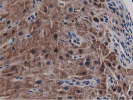 SQSTM1 Antibody - IHC of paraffin-embedded Human Ovary tissue using anti-SQSTM1 mouse monoclonal antibody. (Heat-induced epitope retrieval by 10mM citric buffer, pH6.0, 100C for 10min).