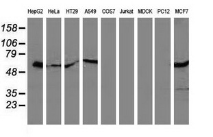 SQSTM1 Antibody - Western blot of extracts (35 ug) from 9 different cell lines by using anti-SQSTM1 monoclonal antibody (HepG2: human; HeLa: human; SVT2: mouse; A549: human; COS7: monkey; Jurkat: human; MDCK: canine; PC12: rat; MCF7: human).