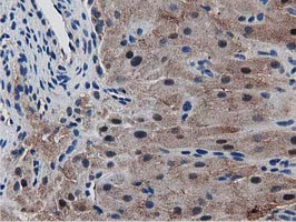 SQSTM1 Antibody - IHC of paraffin-embedded Human Ovary tissue using anti-SQSTM1 mouse monoclonal antibody.