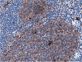 SQSTM1 Antibody - IHC of paraffin-embedded Human lymph node tissue using anti-SQSTM1 mouse monoclonal antibody.